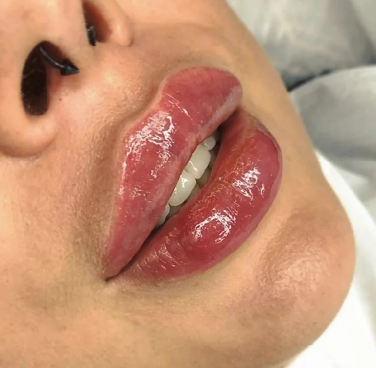 lip tattoo aftercare