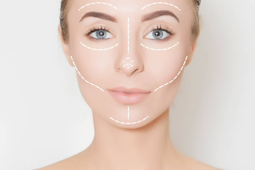 professional microneedling